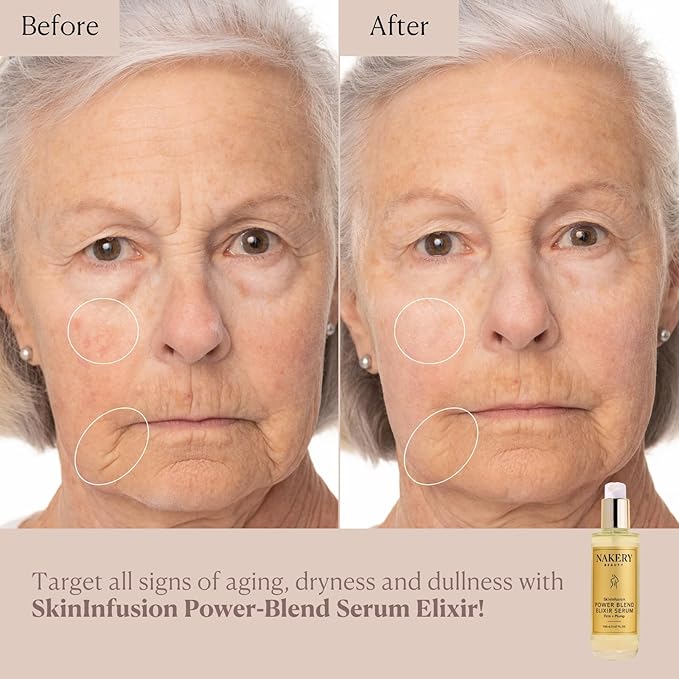 Nakery SkinInfusion Facial Oil Serum (5.07 Fl Oz), Anti Aging Collagen Serum with Hyaluronic Acid, Matrixyl 3000 and Vitamin C Oil, Moisturizing Brightening Treatment for Dark Spots and Dry Skin