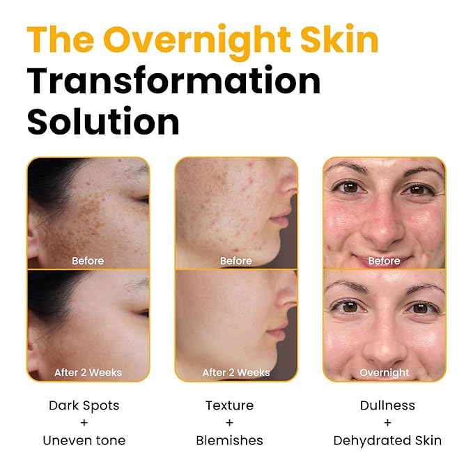 QUIA Turmeric + Kojic Acid Overnight Wrapping Mask – Hydration Mask for Glowing Skin – Evens Tone, Soothes Redness and Improves Skin Texture – Korean Skincare 75ML