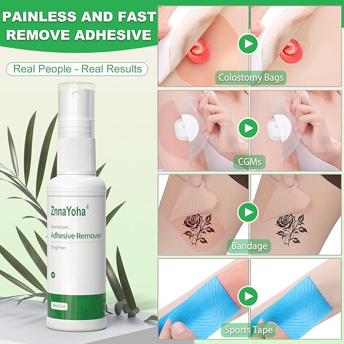 Adhesive Remover Spray, No-Sting Medical Adhesive Spray, Ideal for Ostomy Patients, Sensitive Skin and Bandage Removal, Low Residue, Quick Dry, Non-Sticky Formula,3oz/ 90ml
