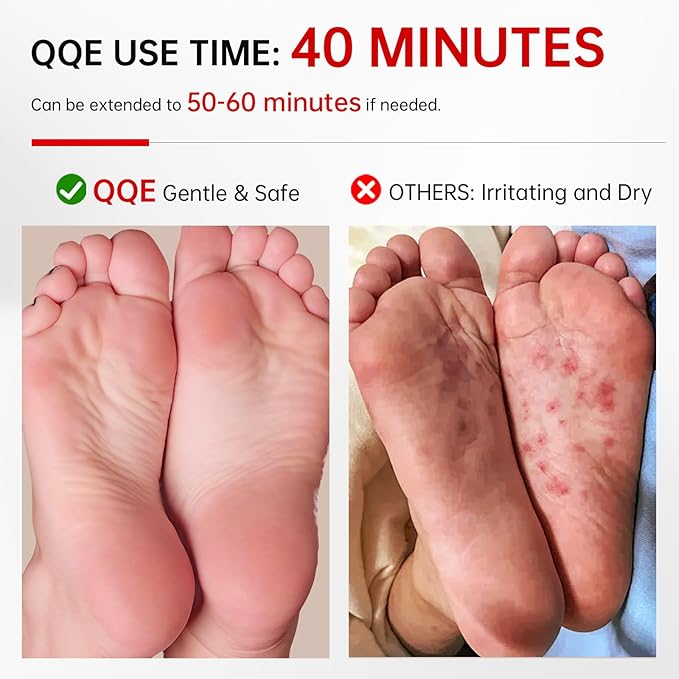 QQE 3 Pack Foot Peeling Mask, Hydrating Exfoliating Foot Mask for Dry Cracked Feet, Callus Remover & Cracked Heel Repair & Foot Care