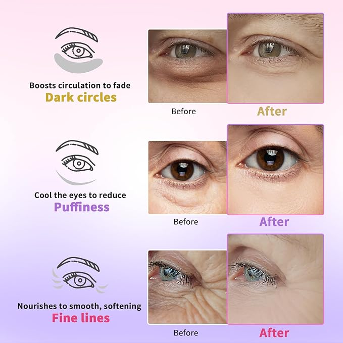 AILEORY Under Eye Patches for Dark Circles, Puffiness, Fine Lines, Eye Mask Set with Retinol, 24K Gold, Caffeine, Gel Mask for Birthday & Spa Party Favors, Skincare Gift for Women & Men, 24 Pairs
