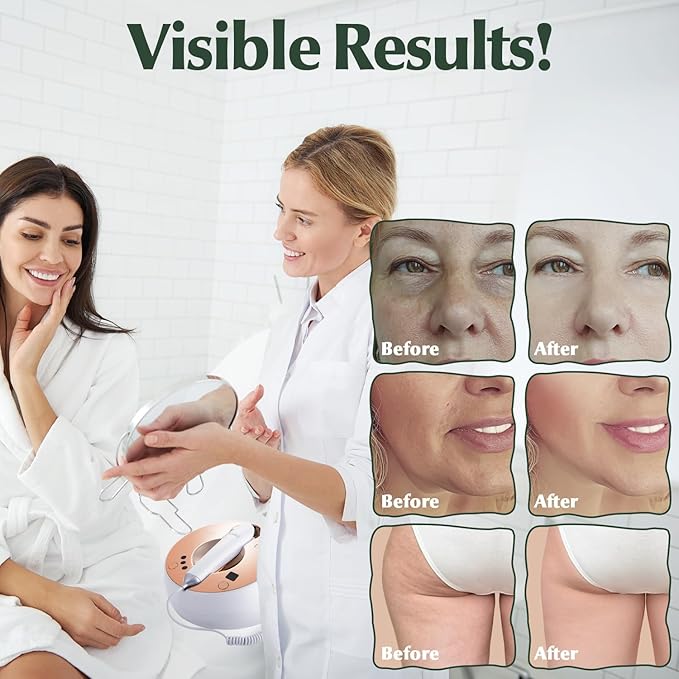 Body Skin RF Radio Frequency Device Home Use
