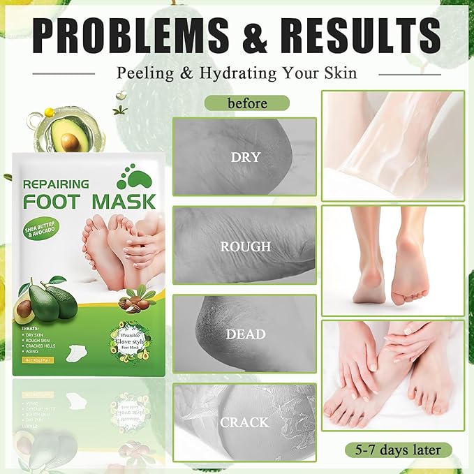 Shea Butter Foot Peel Mask 5 Pairs, Exfoliating Foot Masks for Dry Cracked Feet, Avocado Moisturizing Foot Mask Socks for Women & Men, Hydrating Foot Exfoliator for Soft Smooth Feet