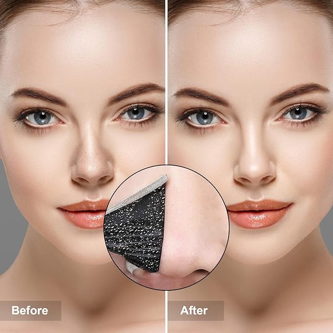 Charmonic Blackhead Remover Pore Strips, 100 Pcs Black Head Remover for Face, Charcoal Nose Strips for Blackheads, Instant Pore Cleaner for Nose Area Face Oil Blackheads Whiteheads for Women