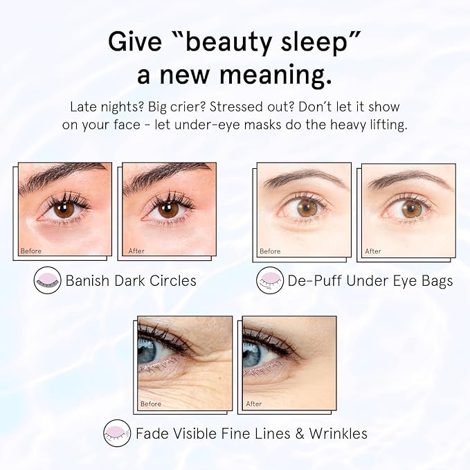 grace & stella Retinol Under Eye Patches for Puffy Eyes and Dark Circles, Restoring Gel Under Eye Masks with Hyaluronic Acid - Vegan Cruelty-Free Skincare - Christmas Gifts for Women (Purple, 6 Pairs)