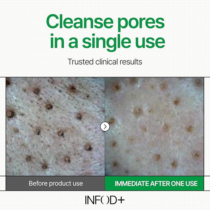 INFODPLUS XCESPI316 Gel Cleanser – Exosome & Walnut Powder | Foaming Korean Face Wash for Deep Pore Cleansing, Blackhead Care & Hydration