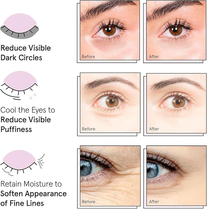 grace & stella Award Winning Under Eye Mask - Xmas Stocking Stuffers under 10, Gel Eye Patches for Dark Circles, Puffy Eyes, Wrinkles, Undereye Bags, Gifts for Women - Vegan, Self Care (6 Pairs, Gold)