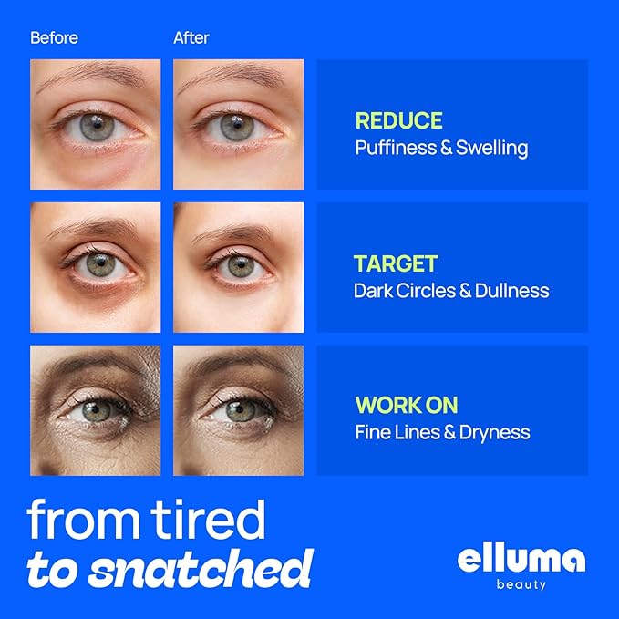 Elluma Beauty Under Eye Patches 12 Pairs of Themed Hydrogel Eye Gel Pads - For Puffy Eyes and Dark Circles, Under Eye Bags, Wrinkles - Restoring Set with Chamomile
