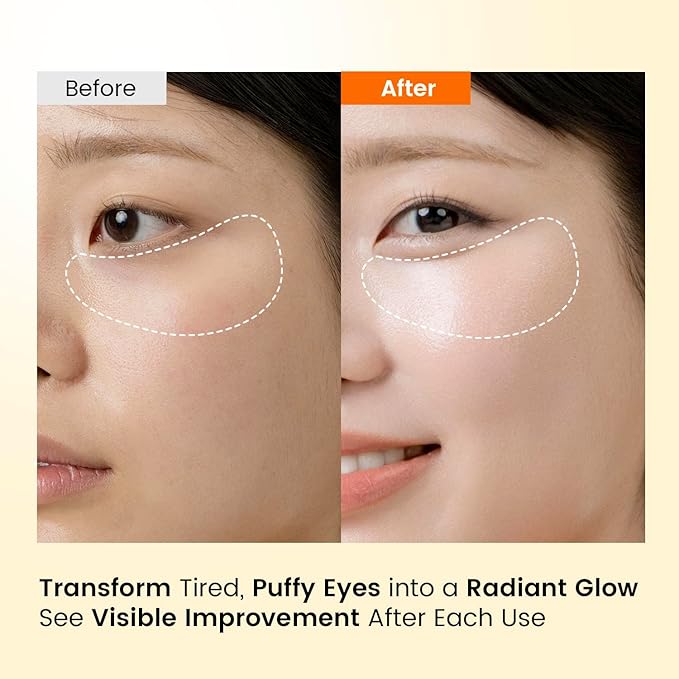 SEONGLOW Caffeine Under Eye Patches: 30 Pairs Korean Hydrogel Eye Masks for Dark Circles Puffiness Relief with Niacinamide Hyaluronic Acid - Undereye Brightening Hydrating Anti-Wrinkle Treatment