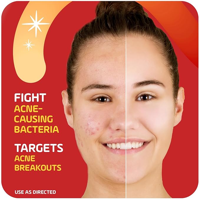 Asepxia 2% Salicylic Acid Acne Spot Treatment Cream | Drying Formula Targets Acne, Clears & Prevents Blemishes, Reduces Redness, Penetrates Pores, Pimple Cream, 1 Oz, 1-Pack