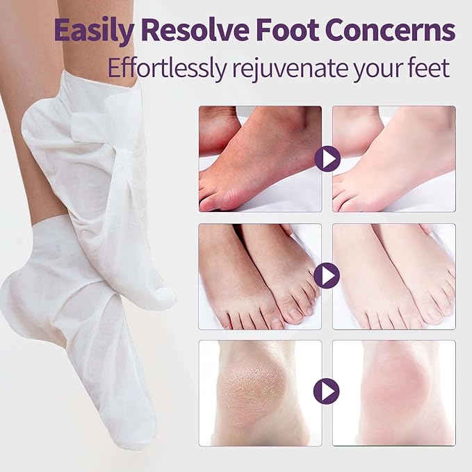 Moisturizing Foot Mask 5 Pack,Hydrating Foot Masks for Dry Cracked Feet,Moisturizing Socks Dry Skin Moisturizer for Soft and Smooth Touch Feet,Foot Care Spa Gifts for Women Men Valentines Gifts