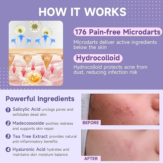 TEAWOO 27-Count Microdart Acne Patches, Cute & Multishaped, Hydrocolloid Pimple Patches with Salicylic Acid & Madecossoside, Microdart Zit Patches for Deep Blemishes & Early Stage Acne (Patented)