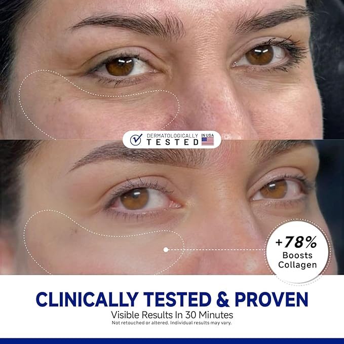 Peptide Under Eye Patches, Firming Eye Patches Instant Reduces Dark Circles and Puffiness, Collagen Under Eye Mask for Bags Treatment, Wrinkles, 12 Pairs