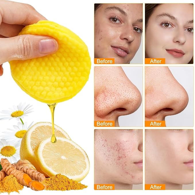 Turmeric Remover Wipes, Exfoliating Face Cleansing Pads with Aloe vera & Centella Asiatica for Hydrating, Moisturizing & Calming for Sensitive Skin, 40ct