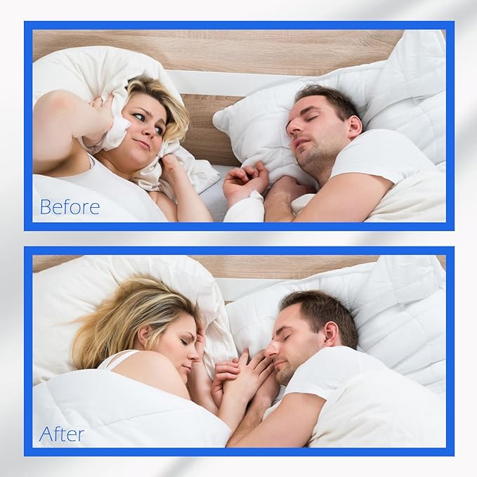 Upgraded Version - Invisible and Transparent Nasal Strips (66mm*19mm) (300)