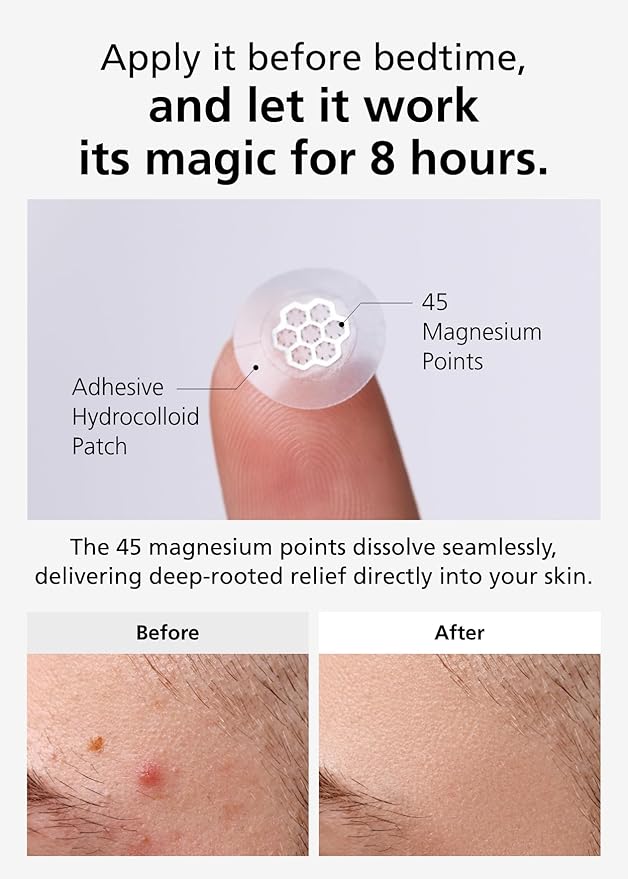 DWEasyDerm Quick Calming Magnesium Patches(20 patches) with Cica Ampoule - Intensive Care, Pimple patches, Hydrocolloid Band, Zits Spot care Overnight Home Care 2-8 hours, New boxs types