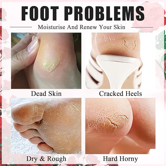 5Pcs Foot Peel Mask for Dry Cracked Feet, Rose Extract Moisturizing Foot Masks, Exfoliating Foot Peeling Socks for Women & Men, Hydrating Foot Mask for Soft Smooth Feet Spa at Home