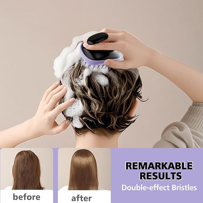 Rebex 2-in-1 Scalp Massager Shampoo Brush,Scalp Scrubber, Exfoliator Brush for Removing Dandruff & Hair Growth,Detangling Scrubber for Wet or Dry Hair (Black Purple)