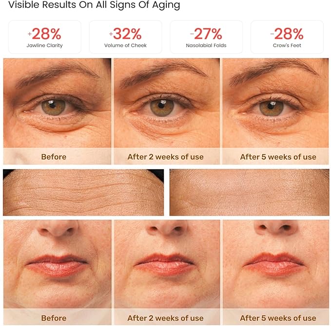 Skin Firming Facial Device, Double Effect 5-in-1Professional Home Beauty Device for Face, Neck, Arms, Abdomen, Legs, 2025 New Upgrade 5 Energy Levels - Salon Results (EP-400)
