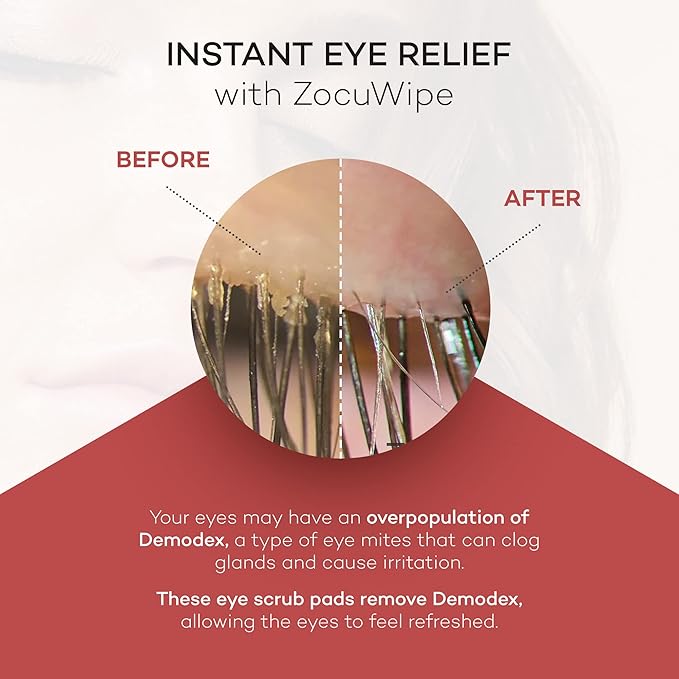 Zocular ZocuWipe Eyelid Cleansing Wipes with Natural Okra Complex – Gentle Daily Eyelid Cleanser & Moisturizing Pads – Makeup Remover & Eye Hygiene Wipes – 30 Count