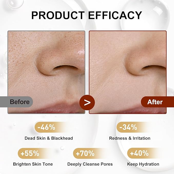 Peel Shot Glow White Rice Ampoule with Niacinamide – Brightening Exfoliating Serum for Face & Body, Hydrating Pore Refining Skin Care, Deep Cleanse & Glow Booster for Dull Uneven Skin, 2.71 fl oz