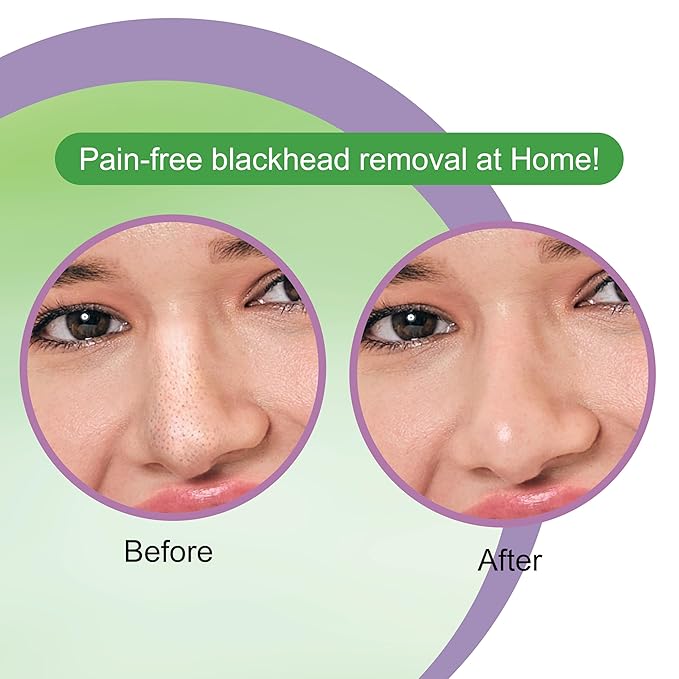 DR.RASHEL Tea Tree Nose Pore Strips For Pore Cleansing, Instant And Painless Blackheads Removal | Deep Purifying Blackhead Remover Strips for Nose | 20 PCS (10 Strips & 10 Wipes)