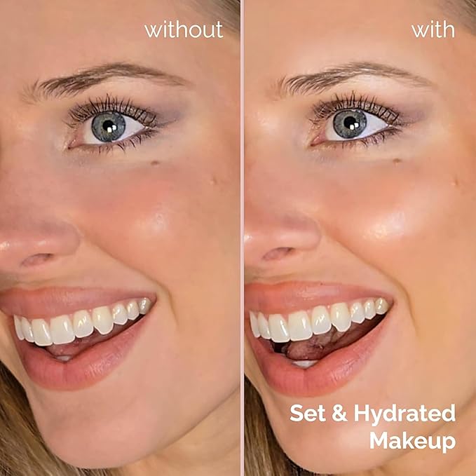 Elizabeth Mott Thank Me Later 3-in-1 Dewy Makeup Setting Spray – Hydrating & Long-Lasting Fine Mist with Niacinamide for a Radiant Glowy Look – Lightweight, Cruelty-Free, Travel-Size Face Spray, 30ml