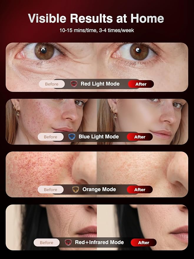 Red Light Therapy for Face，4D Red Light Therapy Mask with 4 Color Light Modes (Red+Infrared/Red/Blue/Orange), 850NM Infrared LED Face Mask Light Therapy with 4000mAh Rechargeable Remote, Timer