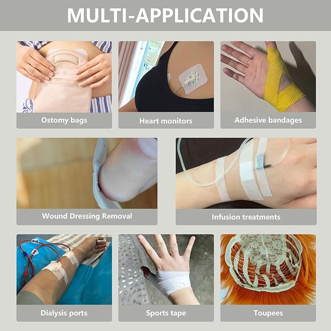 Adhesive Remover Spray,No Sting Medical Adhesive Remover for Skin,Ideal for Ostomy Patients,Sensitive Skin and Bandage Removal,Alcohol Free,50 ml