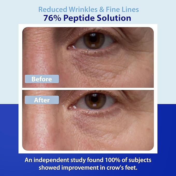 Dr. Denese Wrinkle RX 76% Peptide Solution Concentrate 1 oz – Supports Smoother, Firmer-Looking Skin With Lightweight Hydration – Doctor-Developed Formula for Refined, Youthful-Looking Tone