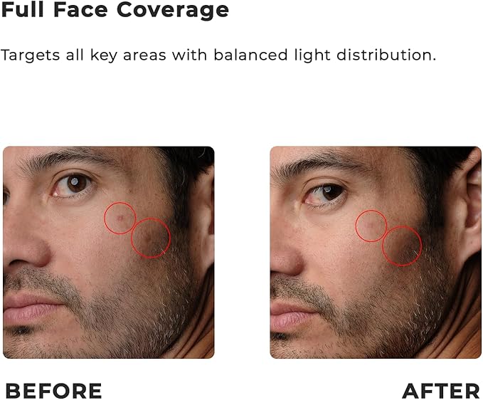 Capillus Red Light Therapy Mask – LED Face Mask Light Therapy 4 in 1 Infrared, Blue & Pink Red Light Mask Face Therapy Device