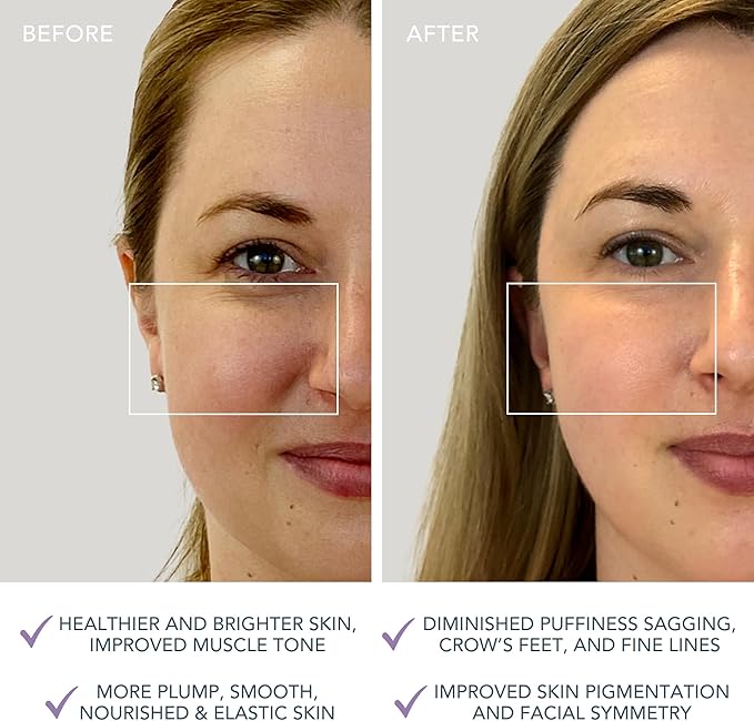 FOREO Bear mini App-Connected Microcurrent Facial Toning Device with 3 Intensities, Lavender