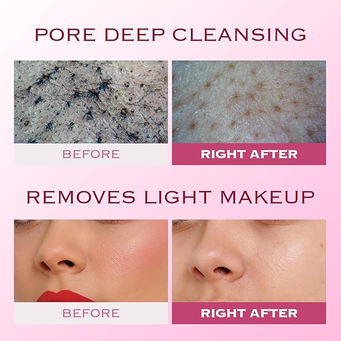 VERY BERRY Pore Deep Cleansing Foam | Berry Complex + Fermented Ingredients for Moisture & Healthy Glow | Gentle Exfoliating Face Scrub for Bumpy Skin | Pore Cleanser | 100g/ 3.52 FL OZ, 4pcs