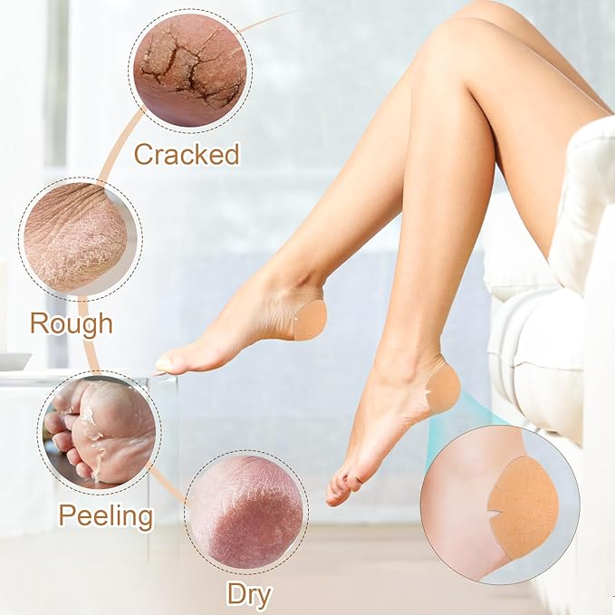 TEAWOO 30PCS Patented Cracked Heel Treatment Patches, New Upgraded Cracked Heel Repair Bandage (80mm x 80mm)