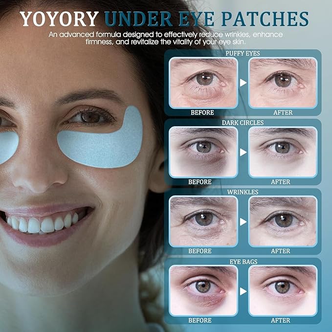 Under Eye Patches Masks - for Dark Circles, puffiness Smoothing Skin Care Treatment, and Fade Wrinkles, Fine Lines with Collagen and Hyaluronic Acid for Women and Men, (30 Pcs) White