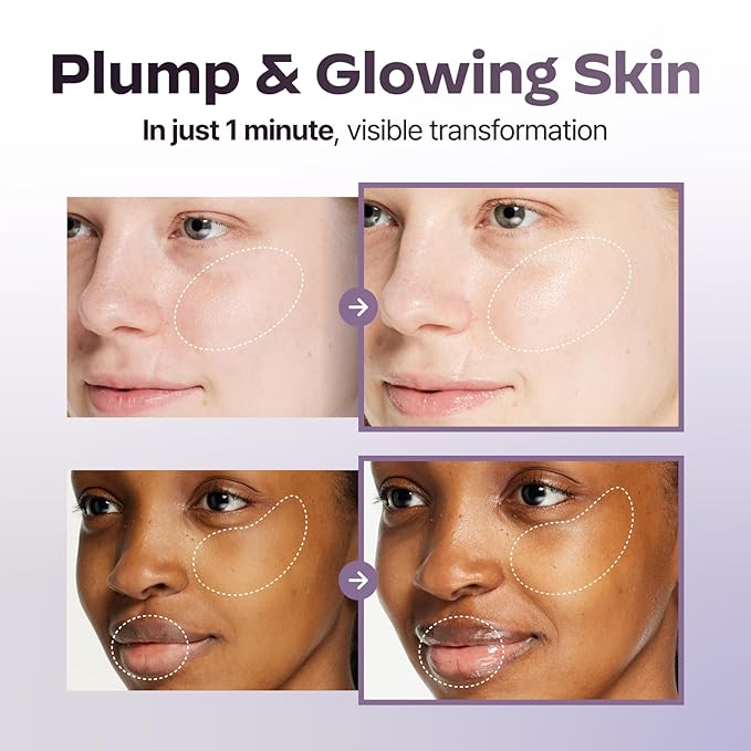 Superform Galvanic Booster Mystic White, 1min booster for ageless skin, anti-aging and firming pocket booster, Korean skincare, glow on the go, Serum booster device, Gift, Stocking Stuffers