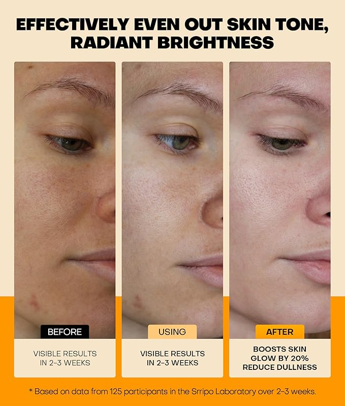 Pure Natural Skin Brightening & Anti Aging 20% Vitamin C Serum, Collagen Peptide Infused Face Serum for Deep Hydration, All-in-One with Niacinamide, Retinol, Hyaluronic Acid, 2.02 Fl Oz
