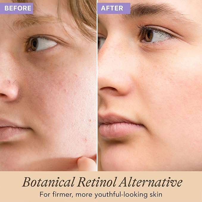Bio Retinol Alternative Bakuchiol Serum - Smooths Skin & Reduces Fine Lines, USA Made with Natural & Organic Ingredients, Anti-Aging Skin Care Formula, Vegan, Cruelty Free