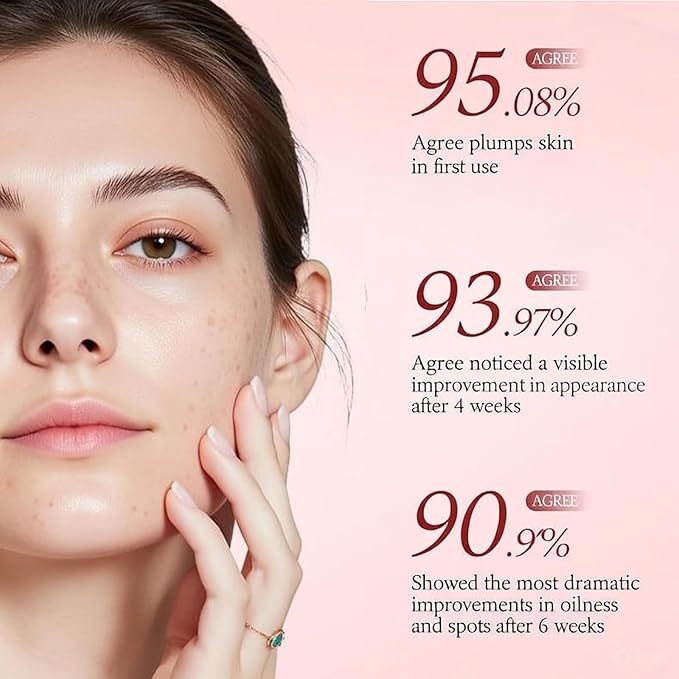 TXA 4% Serum+Niacinamide 10% with Arbutin, Ceramides, Tranexamic Acid Facial Serum, Korean Glass Skin, Refines Skin Texture,Uneven Tone Care 1.Fl.oz/30Ml