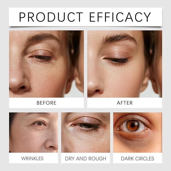 Under Eye Patches for Puffiness and Dark Circles, Hydrogel Eye Mask 60 Pairs to Reduce Fine Lines & Wrinkles, Hydrating Firming Treatment with Glycerin, Daily Eye Care for Men & Women
