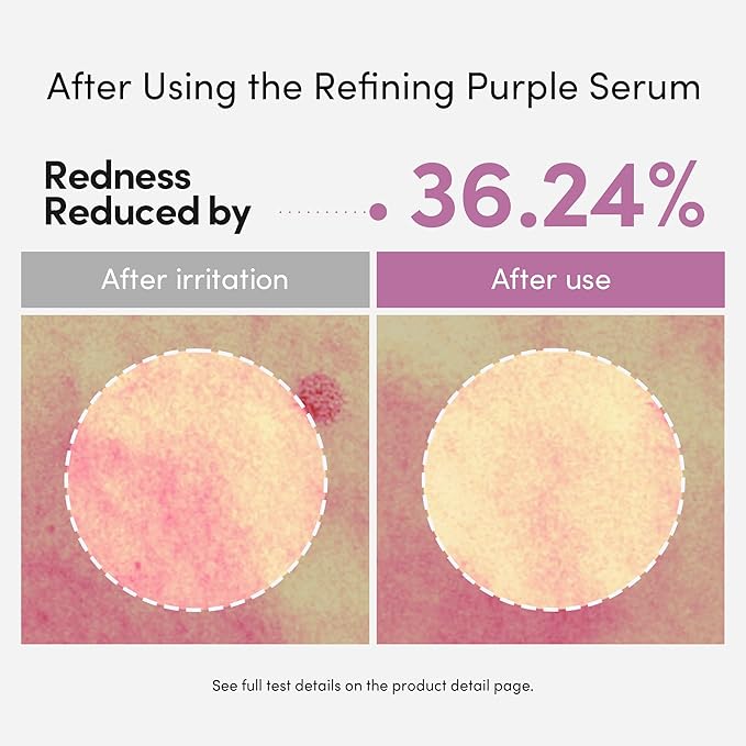 LAGOM Cellus Refining Purple Serum, 10% Azelaic Acid, Ceramide&Panthenol, Herb Extract, Sensitive skin, Redness Soothing, Spot Care, Korean Skincare 1.18 Fl Oz