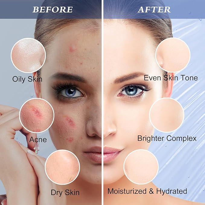 Jelly Mask for Facials Professional, Hydrating & Moisturizing Peel-Off Gel Jelly Face Mask Skin Care for Deep Hydration & Glow, Professional Spa Use for All Skin Types 23 Fl Oz (Hyaluronic Acid)