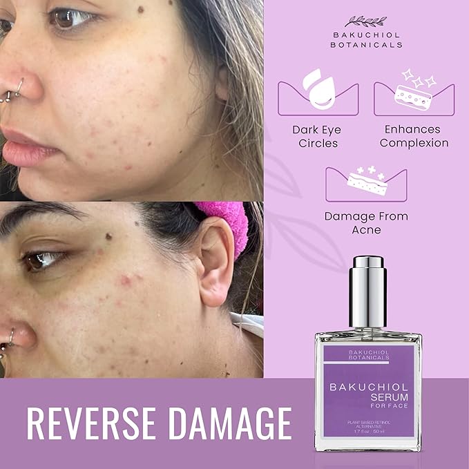 Bakuchiol Botanicals Facial Serum - Natures Plant-Based Retinol - Evens Tone & Complexion - Repairs Acne & Sun Damage - Boost Collagen Production - Smooth Skin - Elasticity - Calms Iritation - 1.7oz