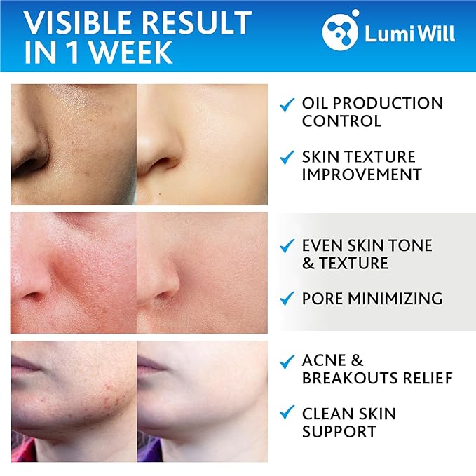 Glycolic Acid Exfoliating Peel Pads with Vitamins B5 C E and Menthol for Acne, Uneven Tone, Fine Lines, Wrinkles, Anti Aging Facial Resurfacing Skin Treatment - 50 Pre-Soaked Pads