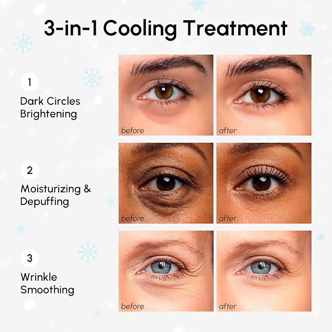 MAREE Eye Gels - Cooling Pads Under Eye Patches for Puffy Eyes and Dark Circles with Collagen & Hyaluronic Acid - Anti Wrinkles Under Eye Masks Skincare Treatment for Puffiness - Parches Para Ojeras