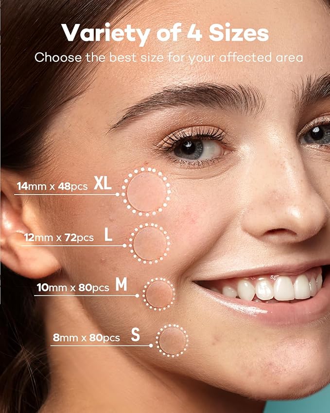 TKTK Pimple Patch Acne Patch, 4 Sizes 280 Patches Acne Absorbing Cover Patch, Hydrocolloid Invisible Acne Patches For Face Zit Patch Acne Dots Tea Tree, Calendula Oil - 2 Pack