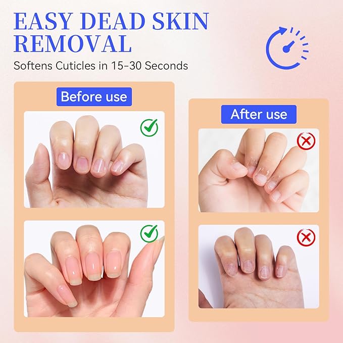 SASSYTIP Cuticle Remover Gel, 15-20 Second Rapid Softening with Jojoba Oil & Vitamin E, Gentle Dead Skin Remover for Hands & Feet, Home & Salon Use, 1 fl. oz. (Clear)