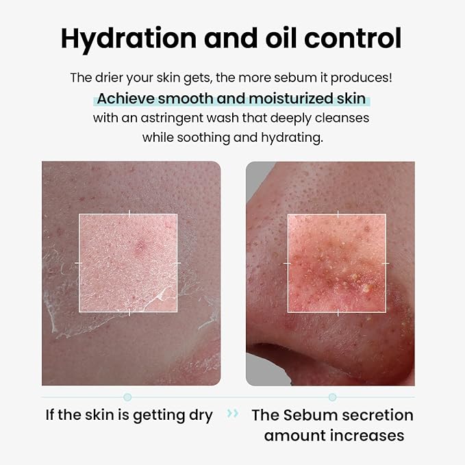 ilso Super Melting Sebum Cleansing Oil, Watery Oil Type, Sensitive Skin Face Wash, Makeup Blackhead Remover, Korean Skin Care 6.75 fl oz (200ml)