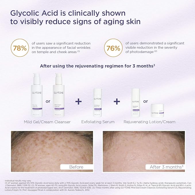Glytone Mild Cream Cleanser | Exfoliate & Moisturize with 3.4 Free Acid Value Glycolic Acid & Glycerin | Face Wash for Women Removes Makeup & Oil | Face Cleanser for Dry Skin | 13.5 Fl oz.