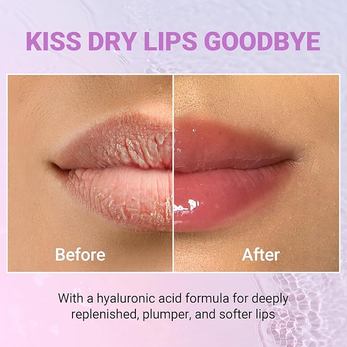 iMethod Lip Mask Overnight - Lip Sleeping Mask for Dry Lips, 8-Hour Hydrating Lip Balm with Hyaluronic Acid, Intense Moisturizing Lip Treatment to Nourish & Repair - Honey